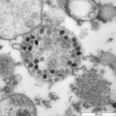 "Вектор" представил фотографии омикрон-штамма коронавируса - nakanune