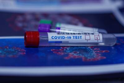 Владимир Чуланов - Пустое занятие: инфекционист опроверг самый главный миф об антителах к COVID-19 - abnews - Covid-19