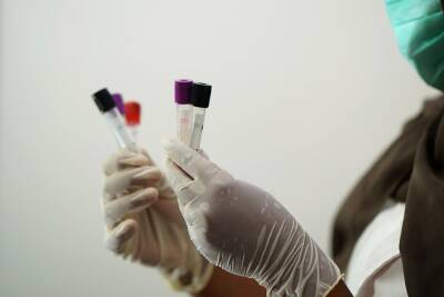 ВИЧ-инфицированная сибирячка рассказала, как переболела COVID-19 - sib.fm - Россия - Иркутск - Covid-19