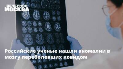 Александр Горелов - Российские ученые нашли аномалии в мозгу переболевших ковидом - vm - Россия