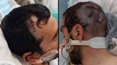 Через 10 дней после теракта: раненный топором в голову Шай пришел в сознание - vesty.co.il - Израиль