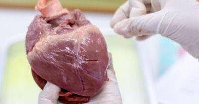 Первая пересадка сердца от свиньи человеку: ученые выяснили, почему она потерпела неудачу - focus.ua - США - Украина - шт. Мэриленд