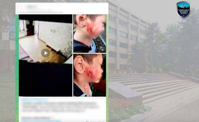 В ГУВД прокомментировали видео ребенка со страшными ожогами, полученными в ташкентском детсаду - podrobno.uz - Узбекистан - Ташкент - район Чиланзарский