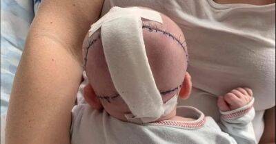 Нарастили череп: в Польше ребенку спасли жизнь, сделав уникальную операцию (фото) - focus.ua - Украина - Англия - Польша - Жешув